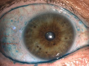צביעת העין באמצעות ליסמין גרין